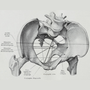 Working on an Anterior Pelvic Tilt